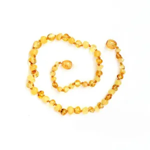 Healing Amber Necklace - 13 Inches