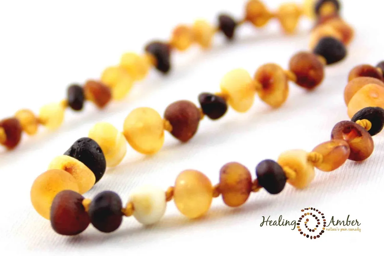 Healing Amber Necklace - 13 Inches